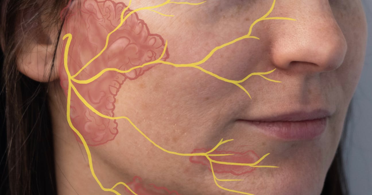 Nerve Damage After Filler Treatments - Harley Academy