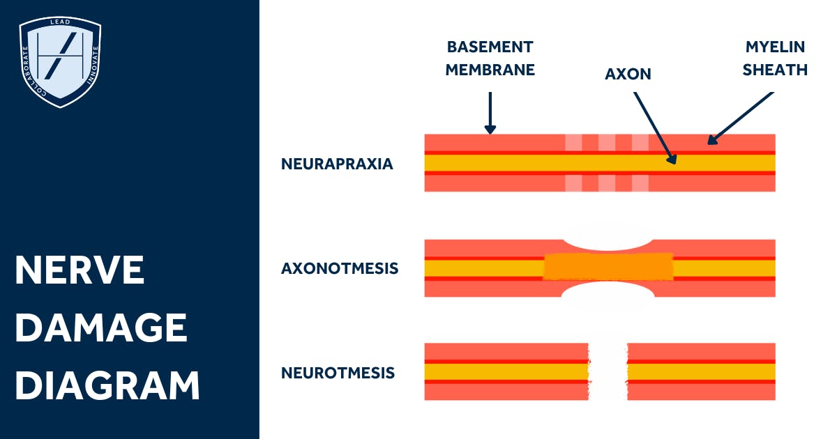 Types Nerve Damage After Dermal Filler Diagram - Harley Academy
