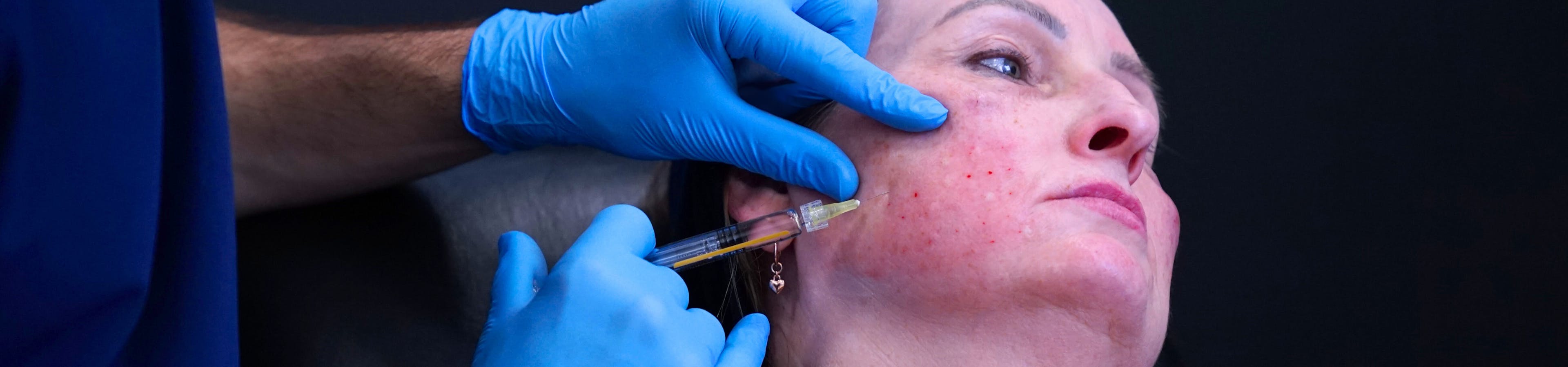 Full Face polynucleotides skin booster treatment during Harley Academy course