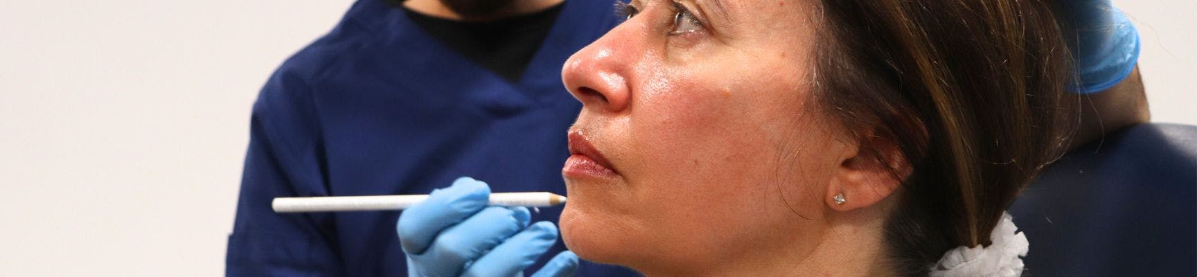 Marking up for dermal filler treatment demonstration at Harley Academy