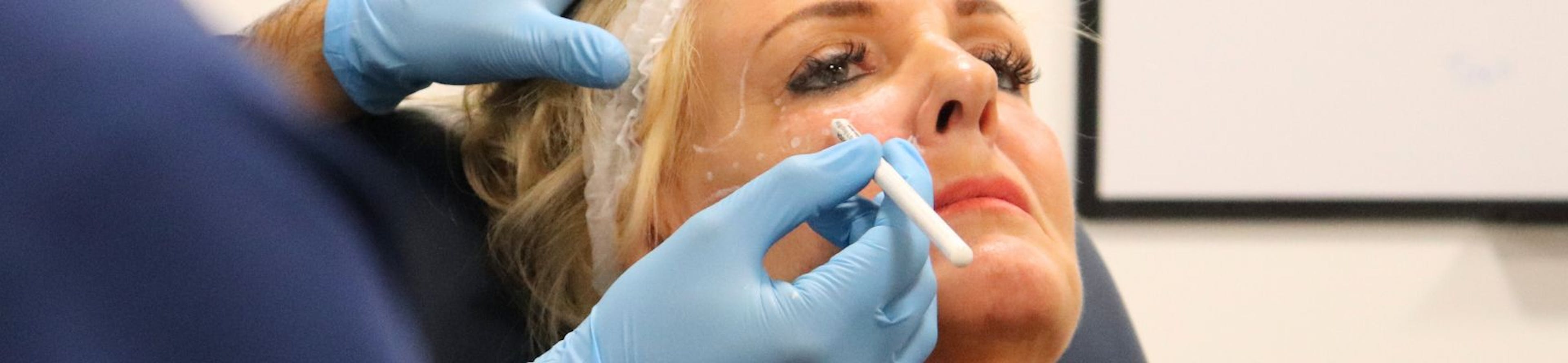 Marking up for mid-face filler treatment demonstration at Harley Academy