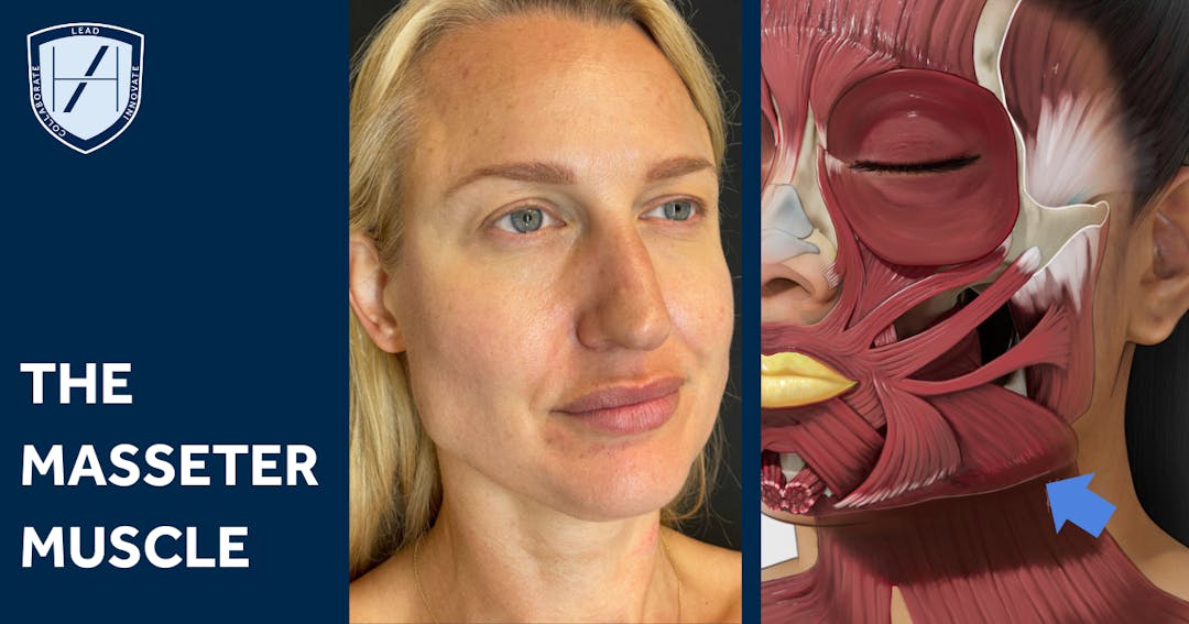 Masseter Botox Injection Techniques for Jawline Slimming | Harley Academy