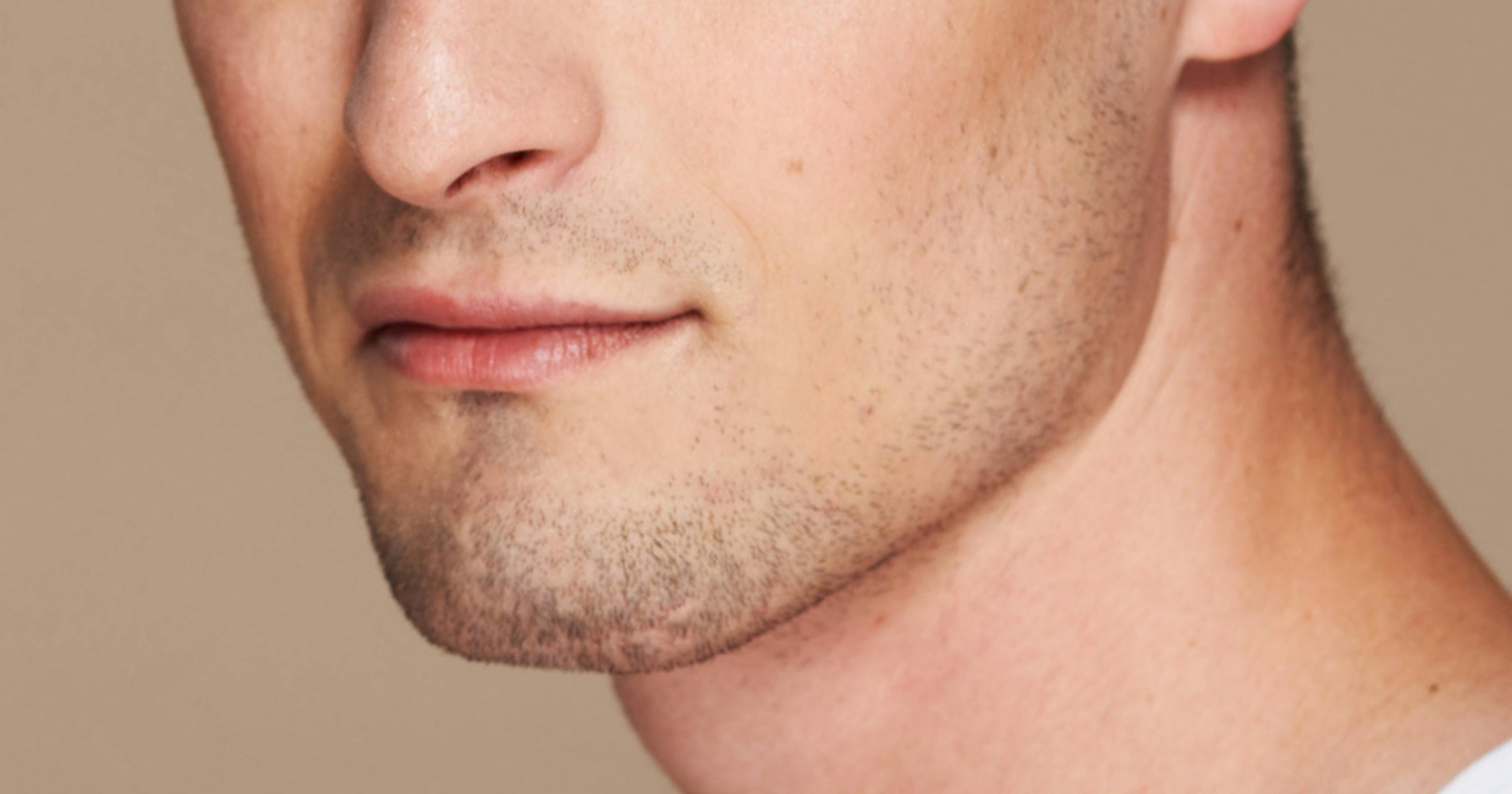 Enhancing the Masculine Jawline - Filler Sculpting Techniques for Aesthetics Practitioners