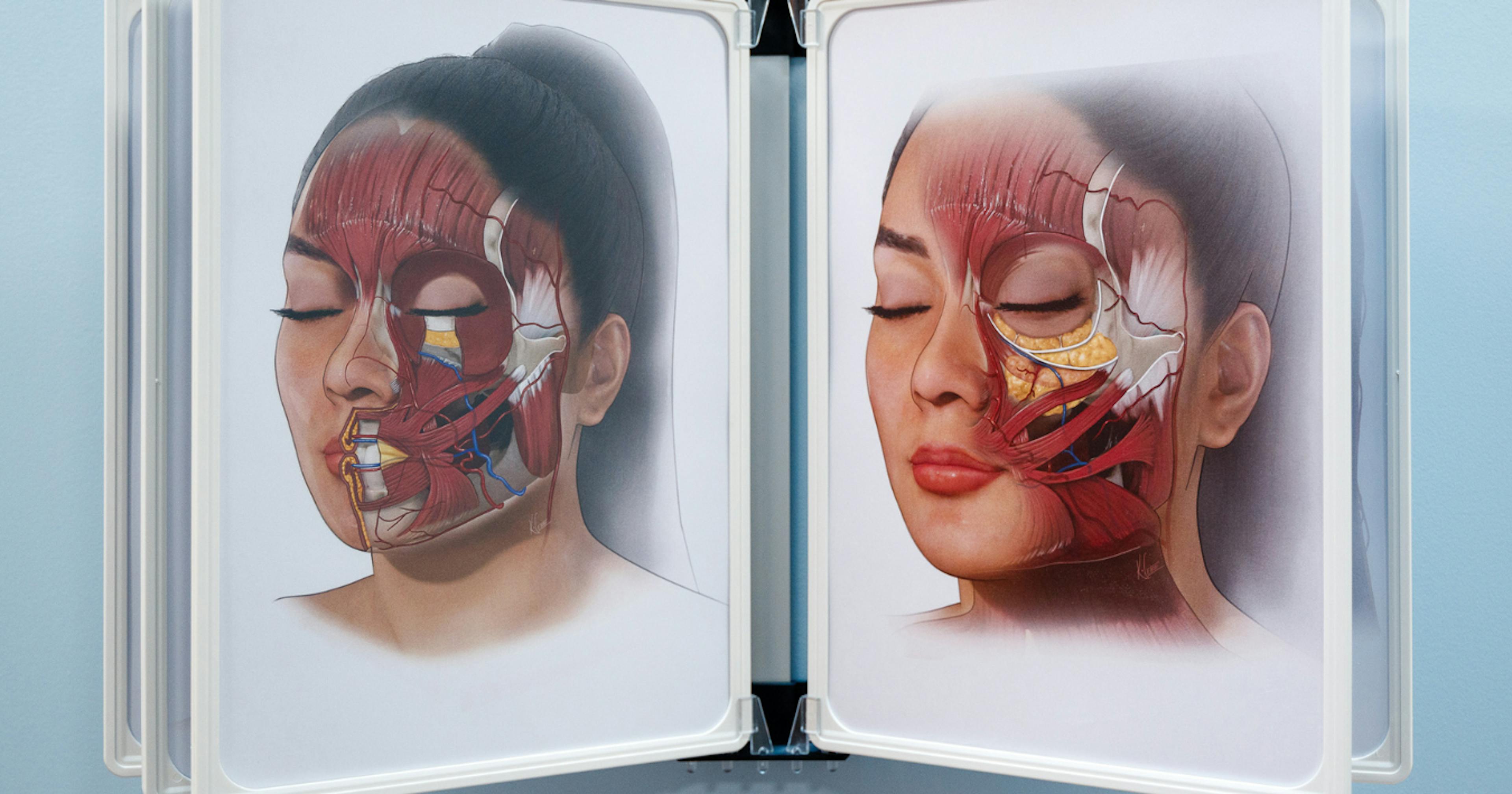 Facial Anatomy for Medical Aesthetics Practitioners