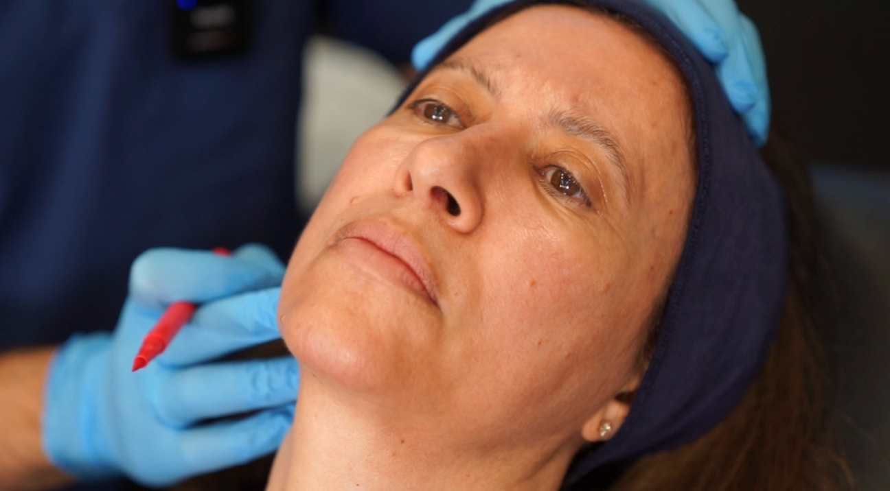 Facial assessment before filler treatment