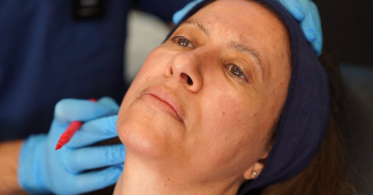 Facial assessment before filler treatment