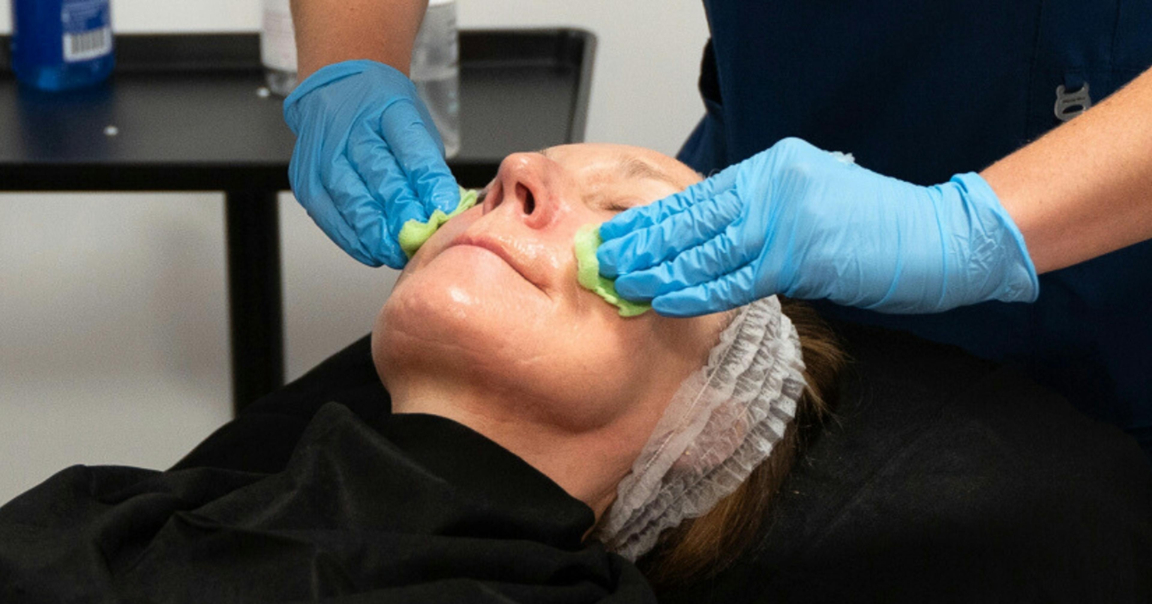 Chemical peel training course at Harley Academy