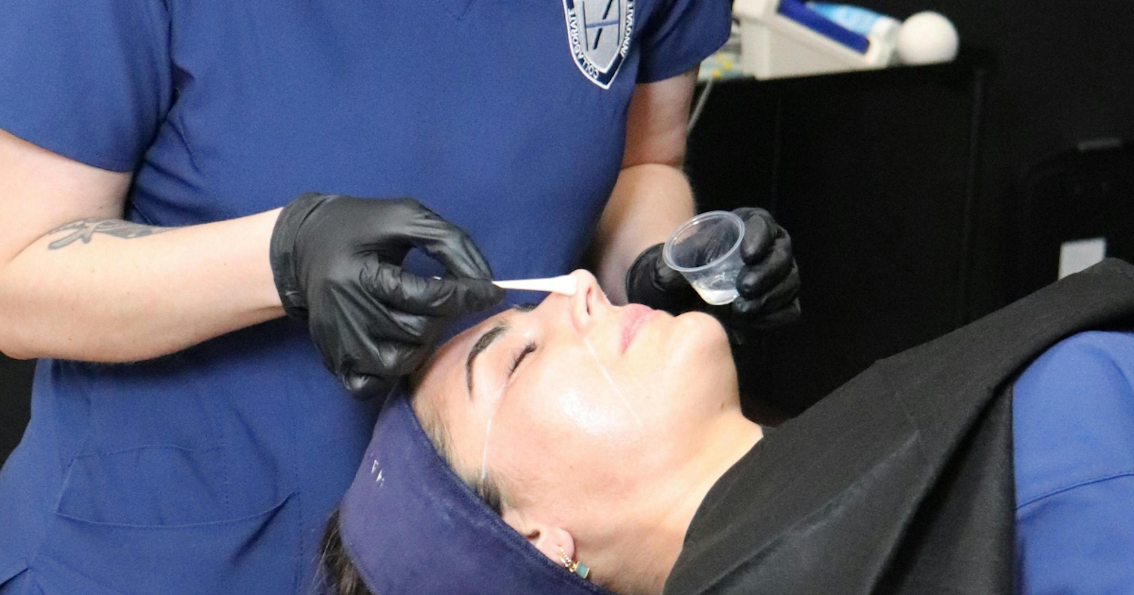 Chemical peel application demonstration