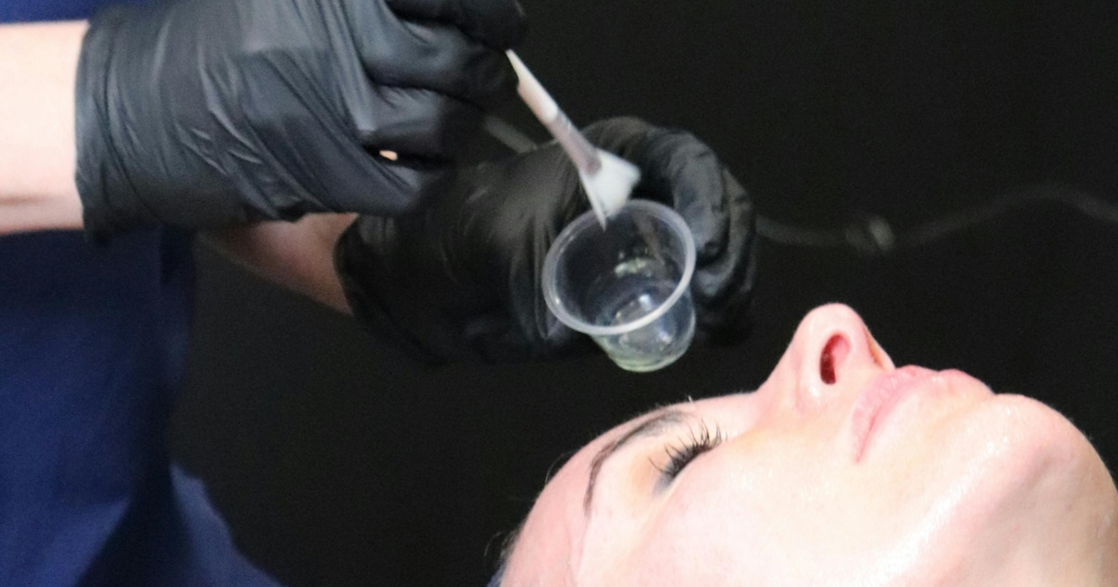 Chemical peel skin treatment training at Harley Academy