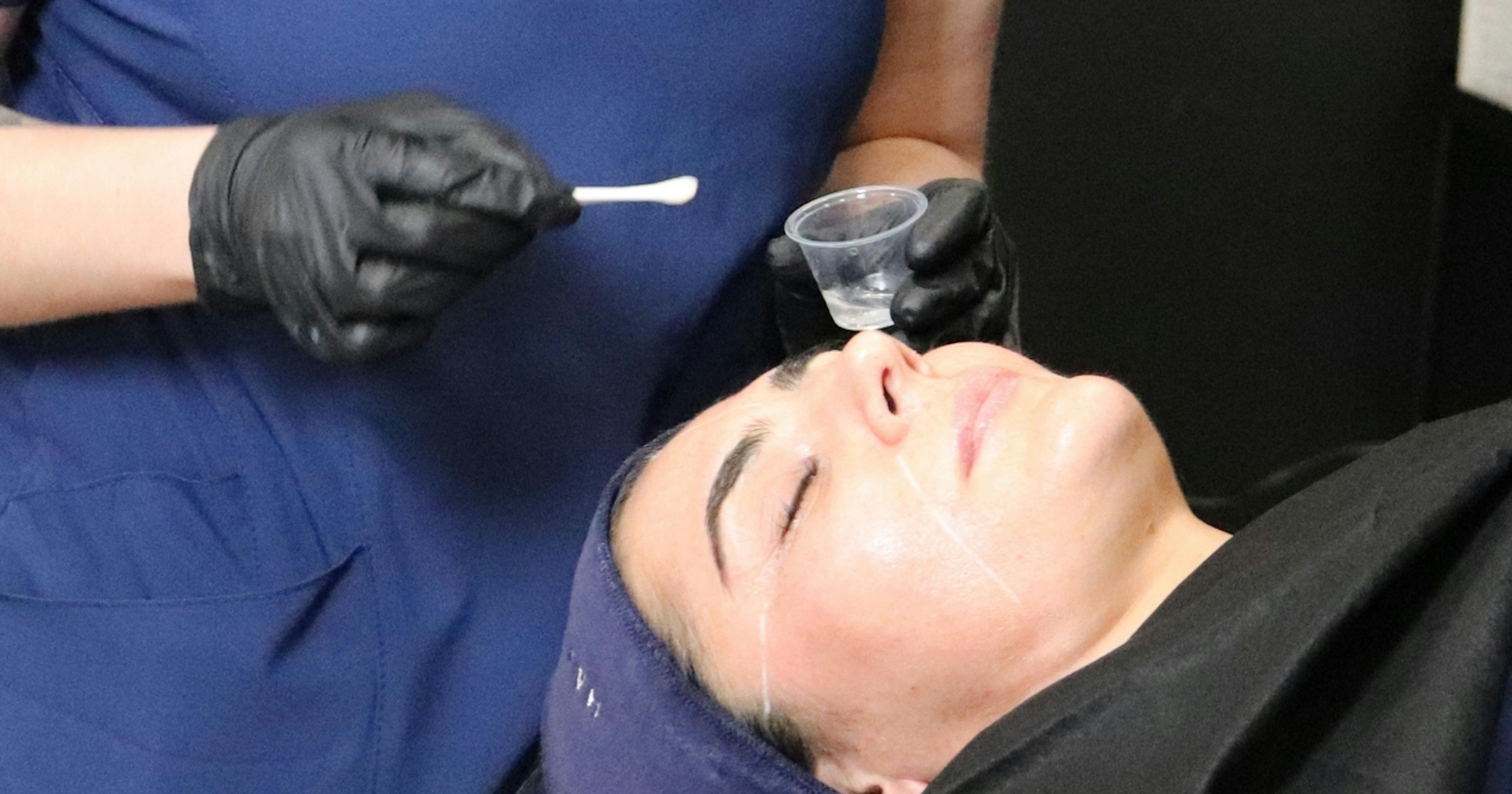 Chemical peel training course at Harley Academy