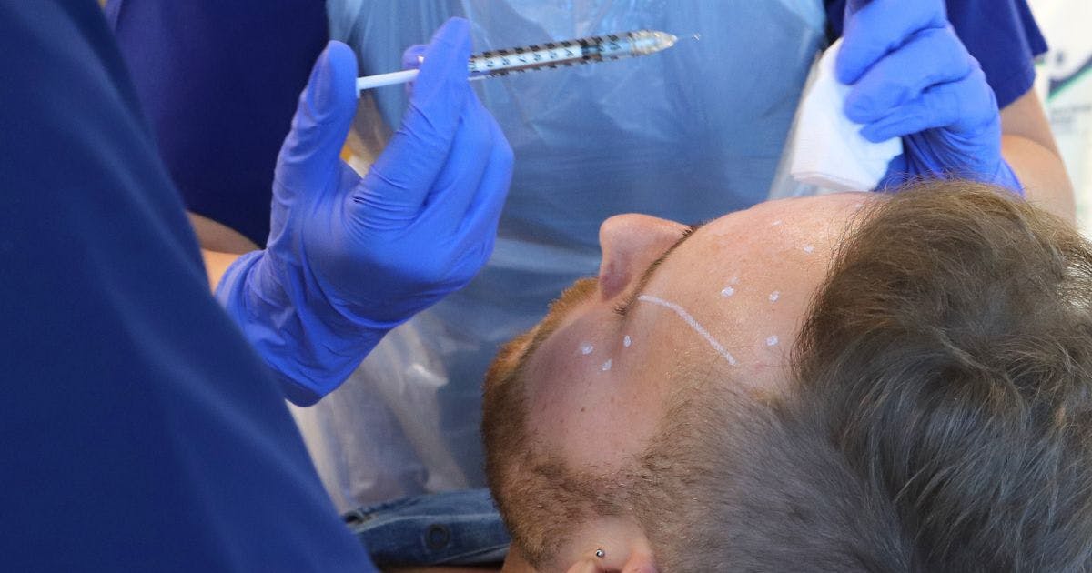 Marking up for upper face botox treatments at Harley Academy
