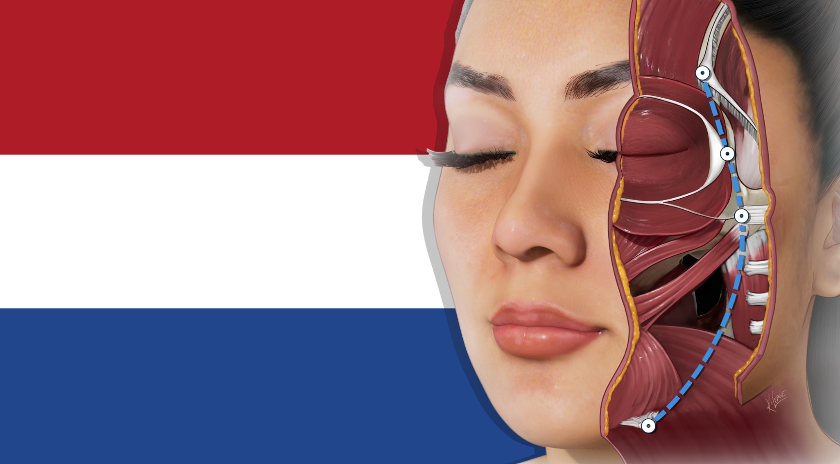 International Advanced Aesthetics Diploma Medical Aesthetics Training for the Netherlands