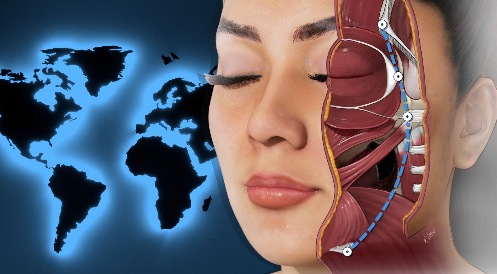 International Advanced Aesthetics Diploma for non UK aesthetic medicine professionals (online course)