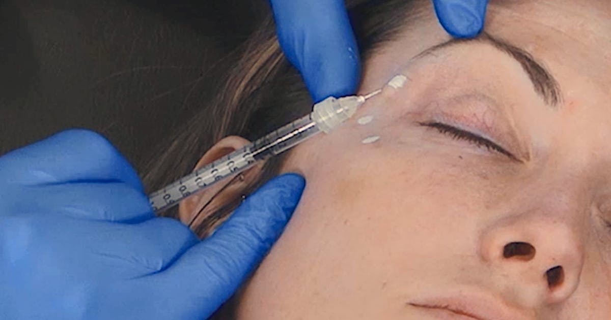 crow's feet botox injection technique - Harley Academy botox course