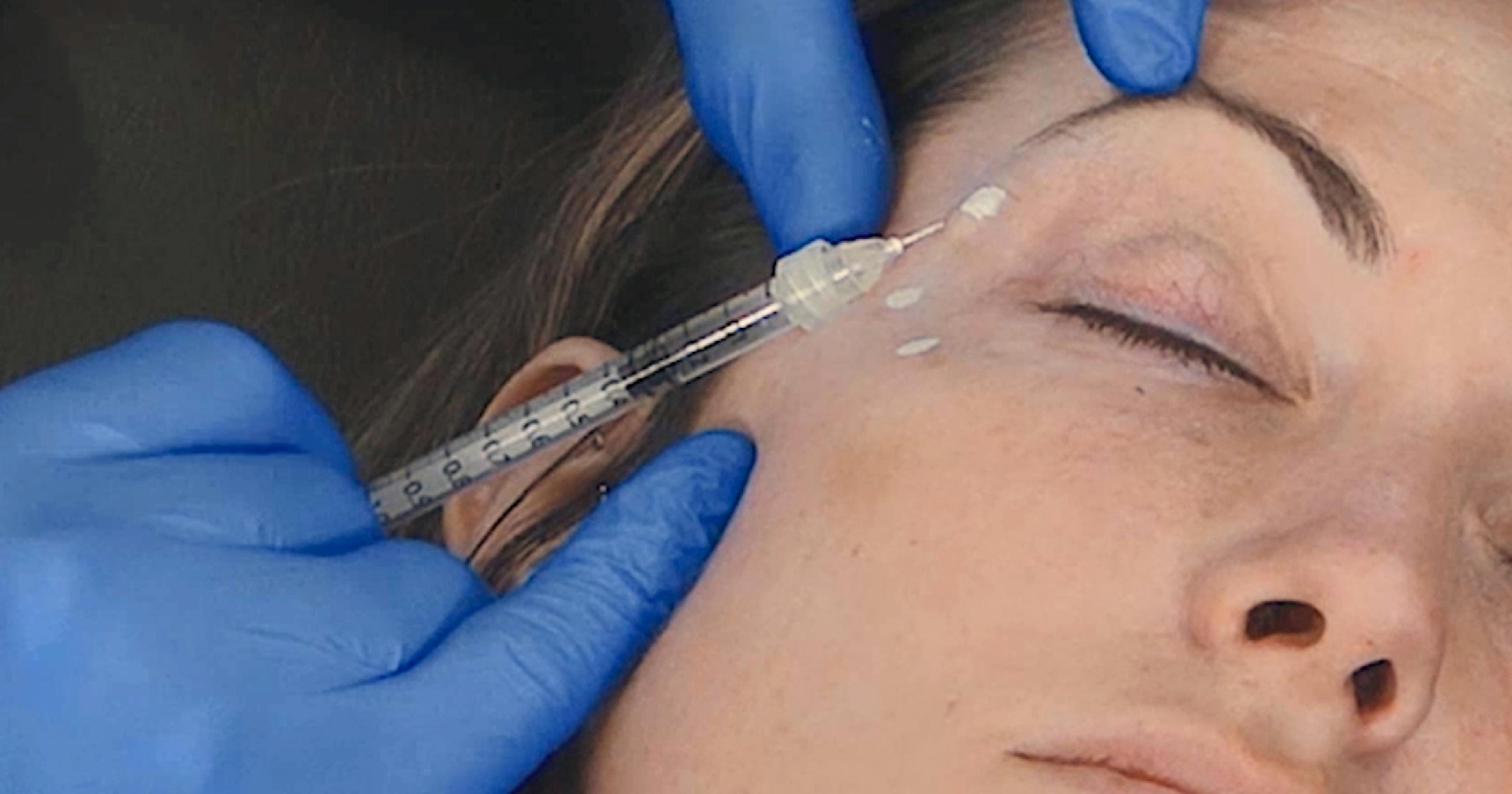 crow's feet botox injection technique - Harley Academy botox course