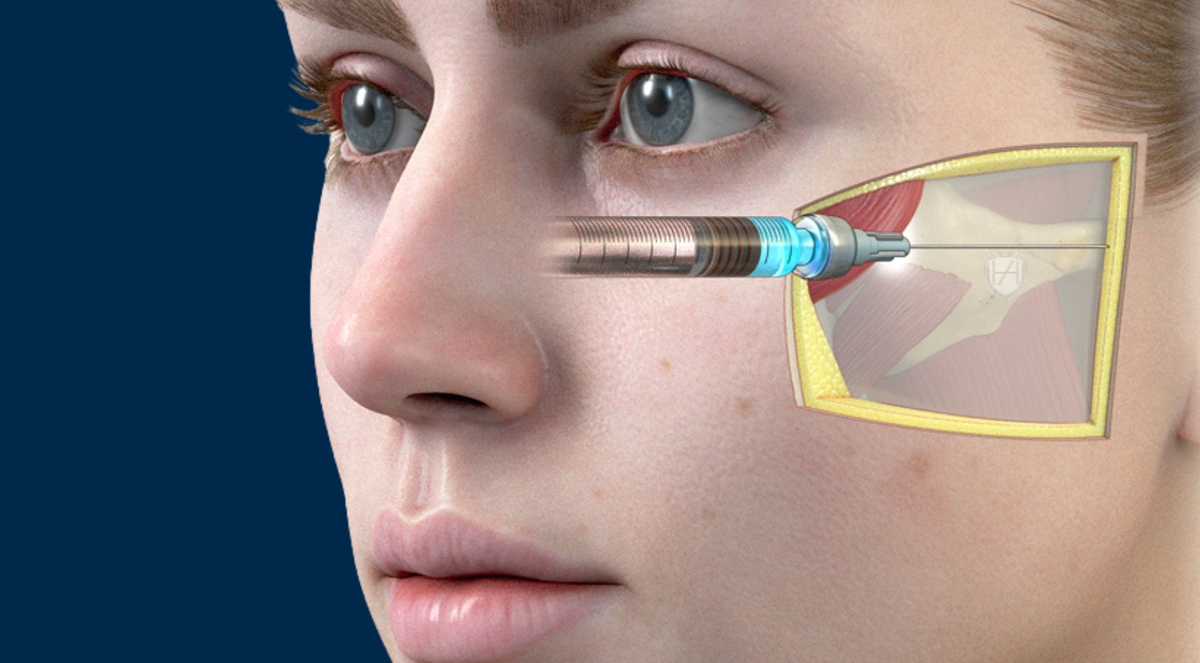 Global Evidence Matrix - GEM advanced theory for aesthetic practitioners