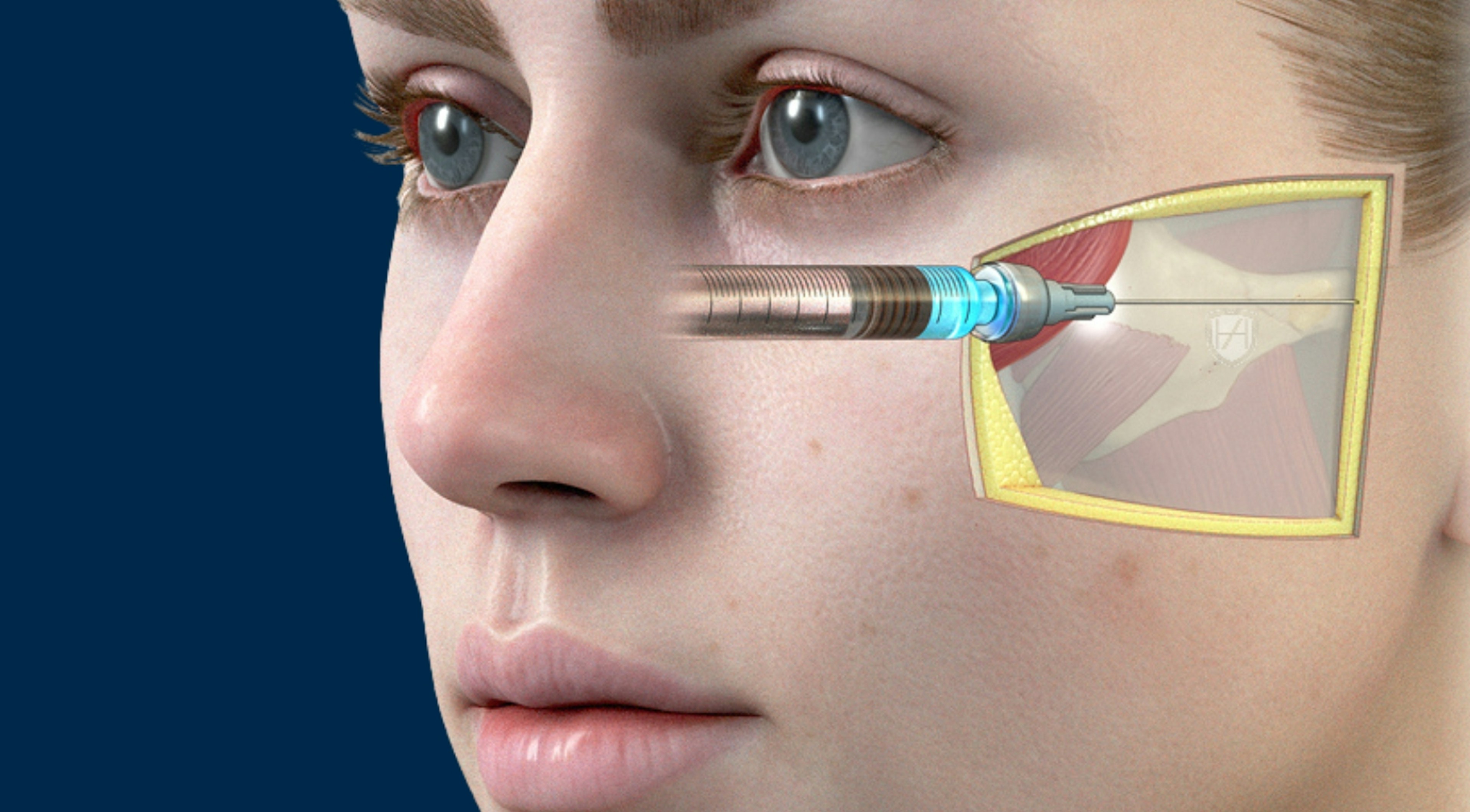 Global Evidence Matrix - GEM advanced theory for aesthetic practitioners