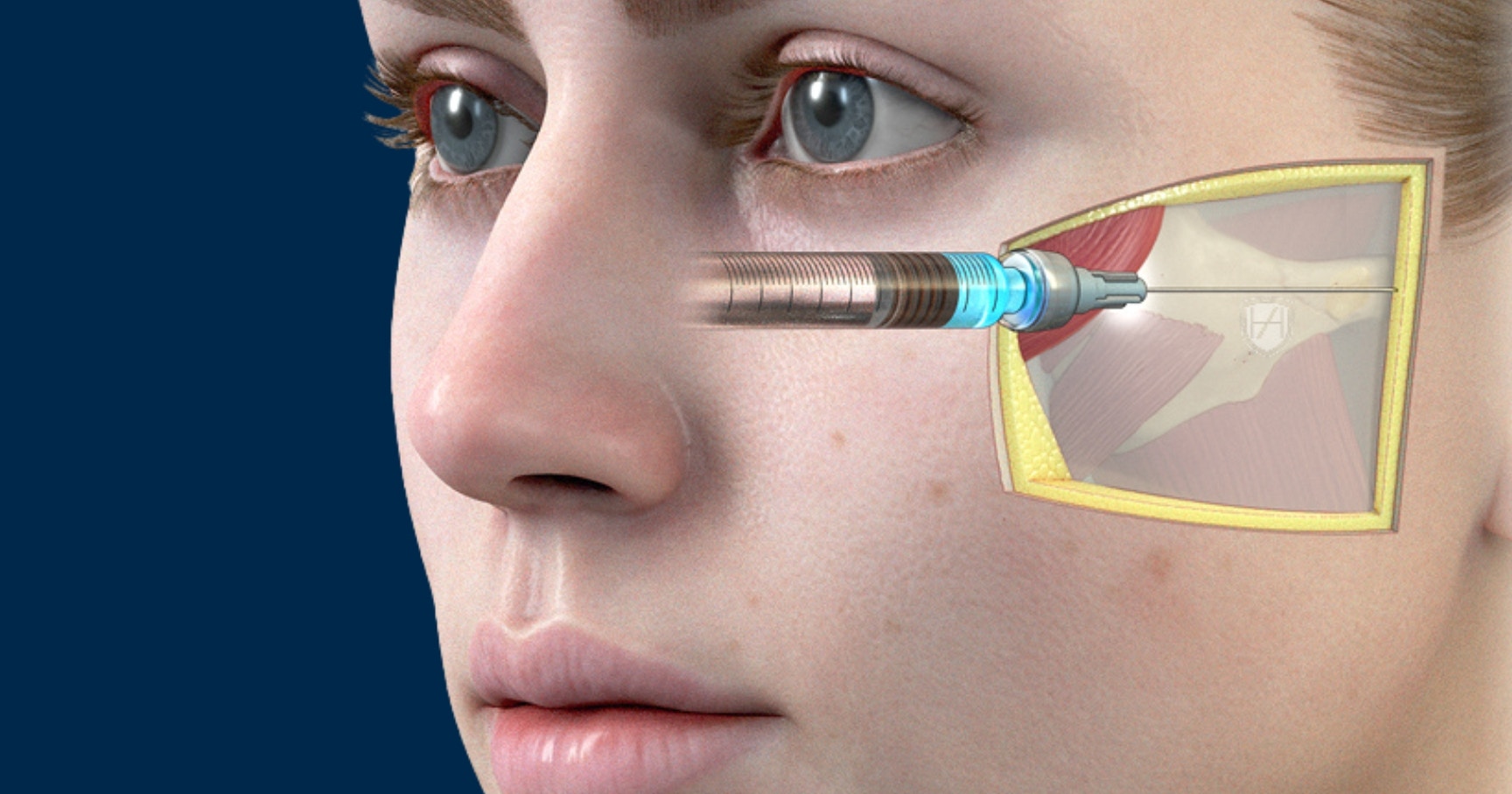 Global Evidence Matrix - GEM advanced theory for aesthetic practitioners