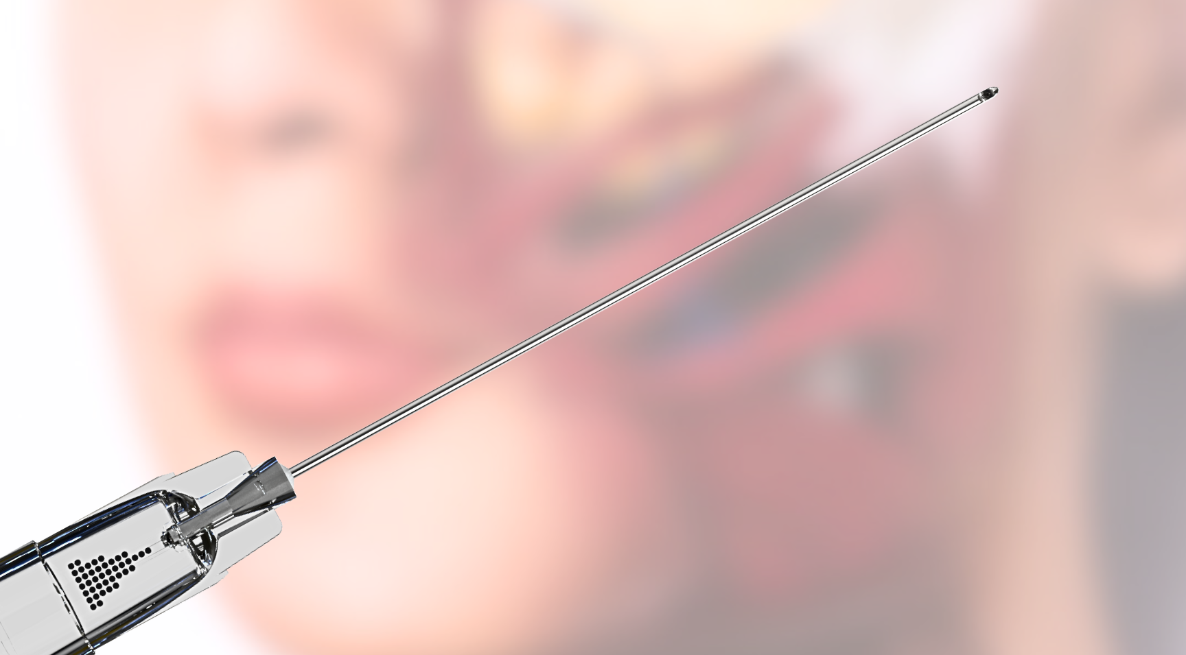 Cannula for subcision and anatomical diagram showing facial anatomy relating to dermal fillers and subcising
