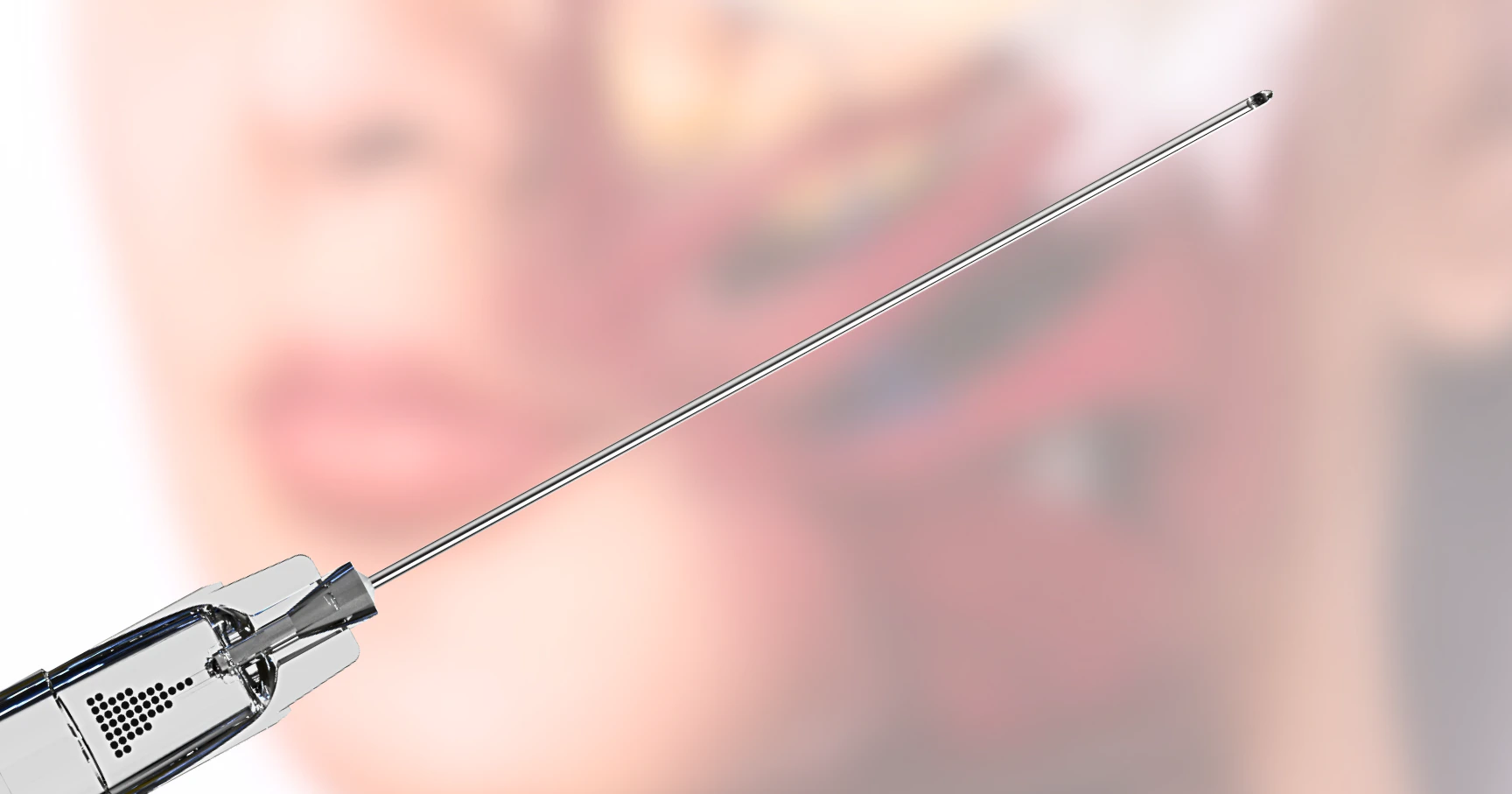 Cannula for subcision and anatomical diagram showing facial anatomy relating to dermal fillers and subcising
