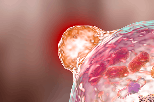 Disabled macroautophagy - Hallmarks of aging