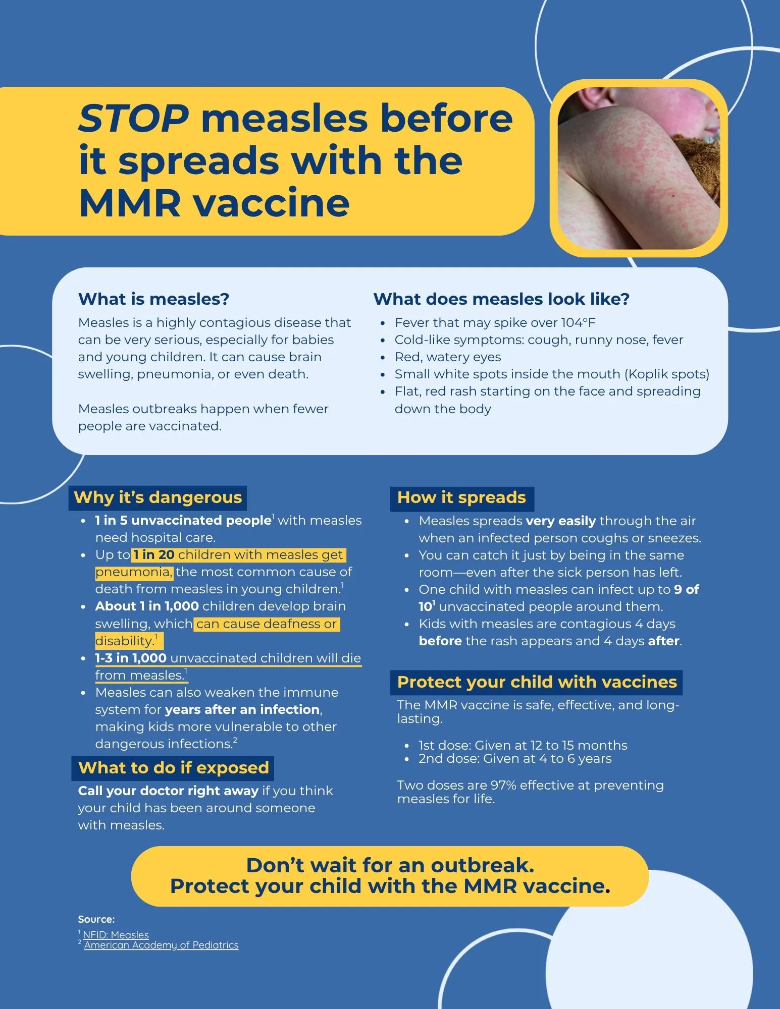 Stop measles before it spreads with the MMR vaccine