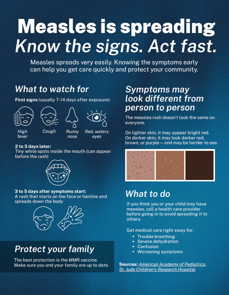 Measles is spreading: Know the signs and act fast