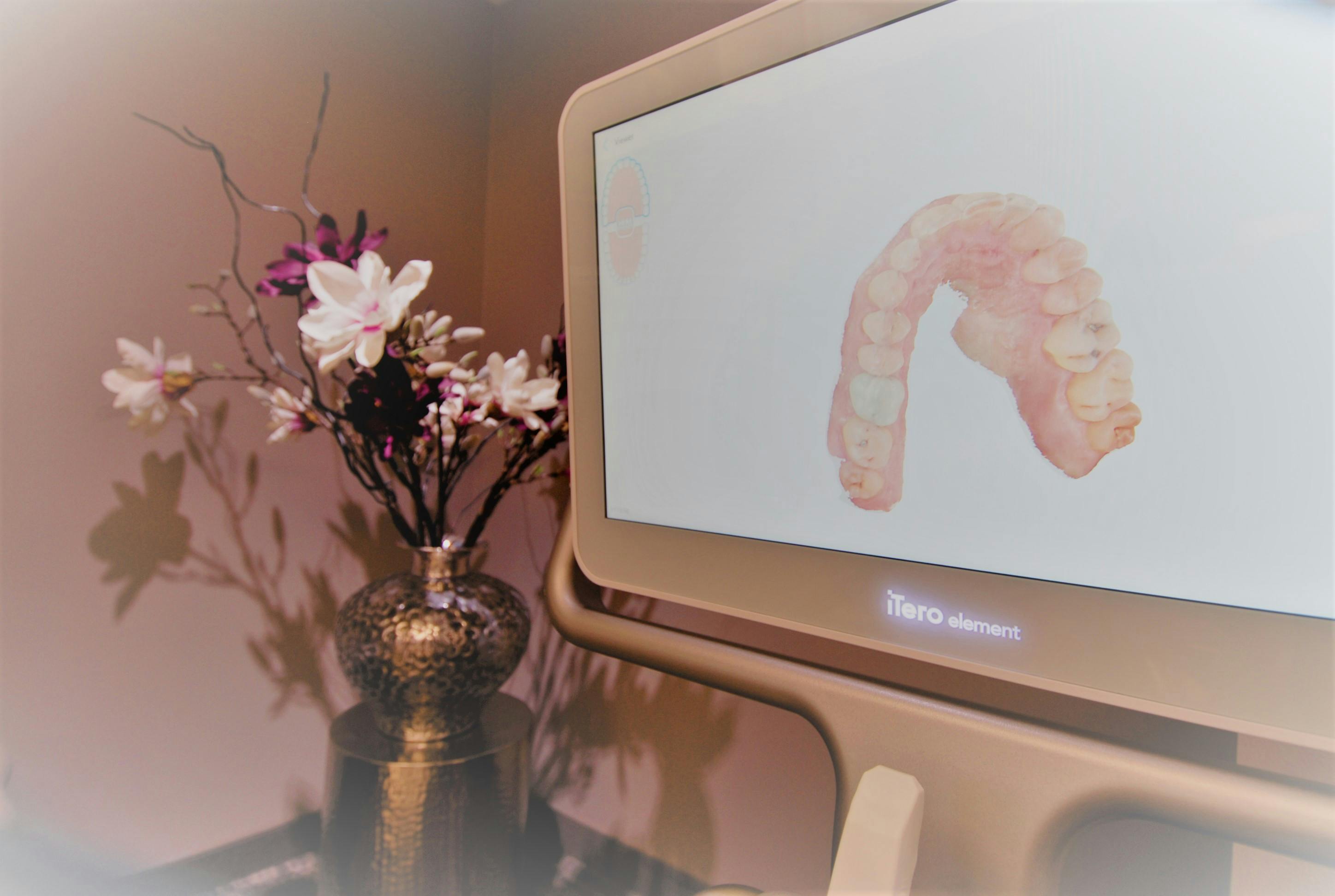 Preventative services - 3D render of teeth