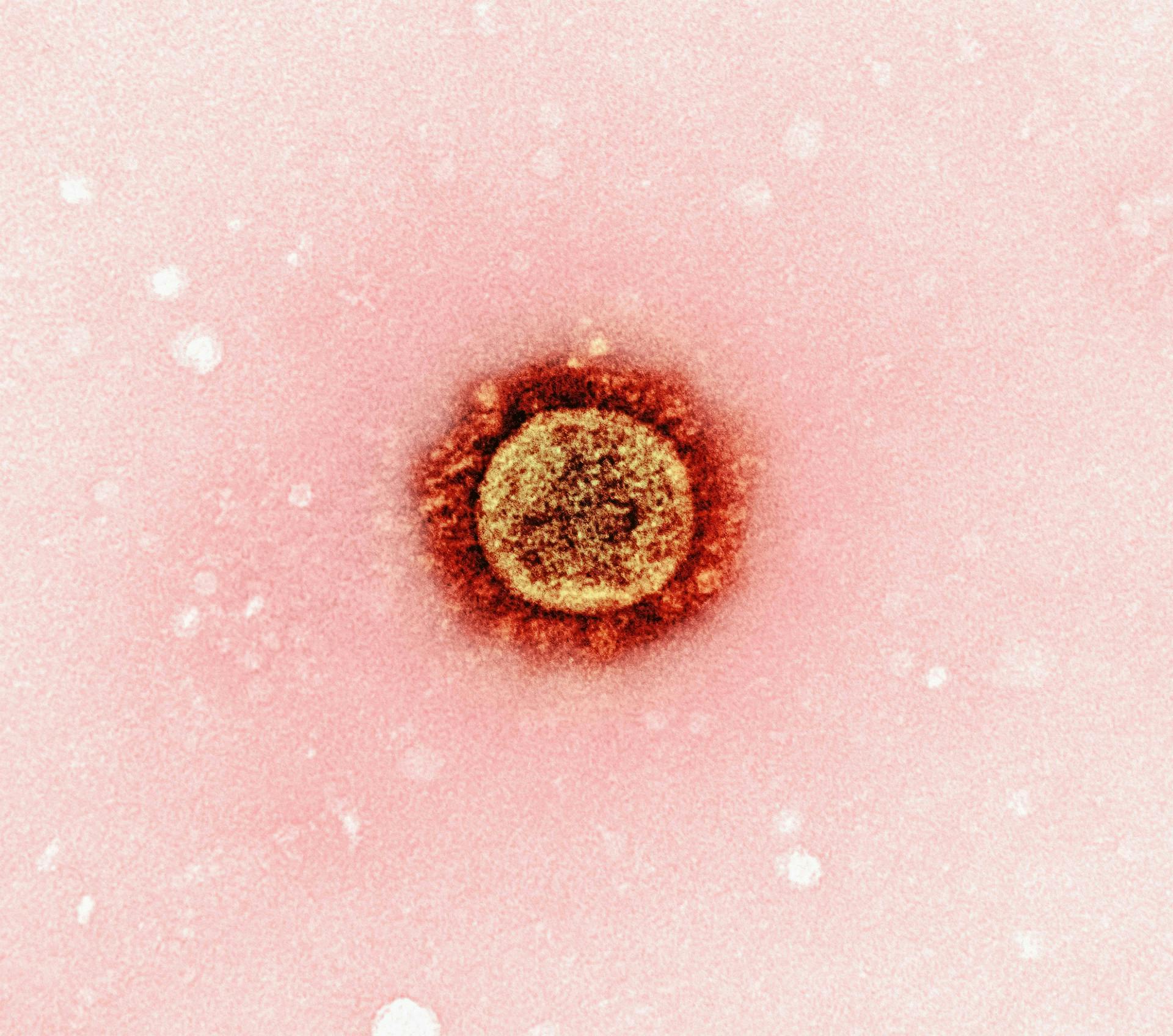 Virus