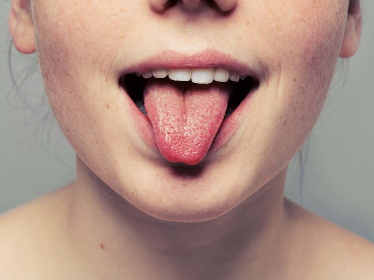 Wat vertelt de kleur van je tong? | Goed Gevoel