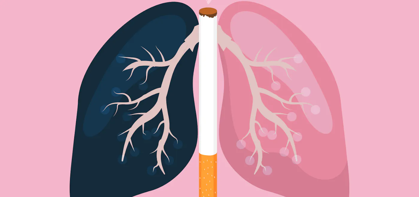 Lung Cancer Awareness and Prevention