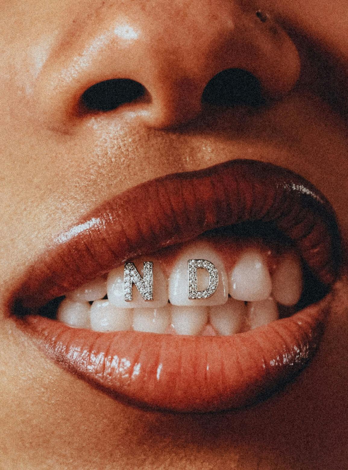 woman with diamond letters on teeth