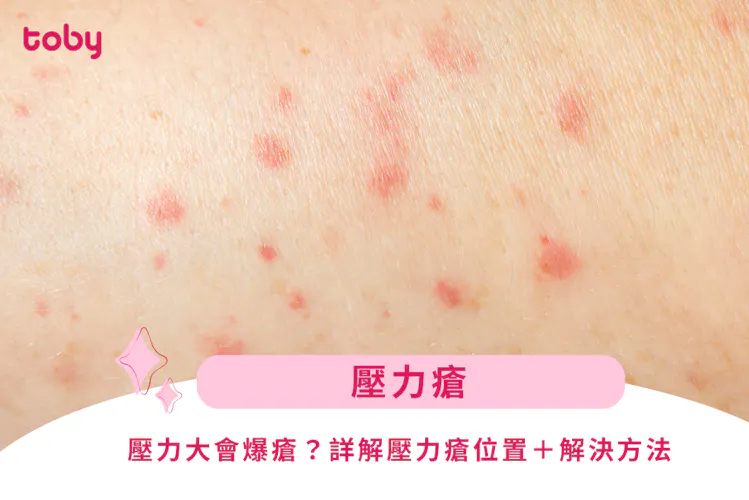 【壓力瘡】壓力大會爆瘡?詳解壓力瘡位置+解決方法-banner