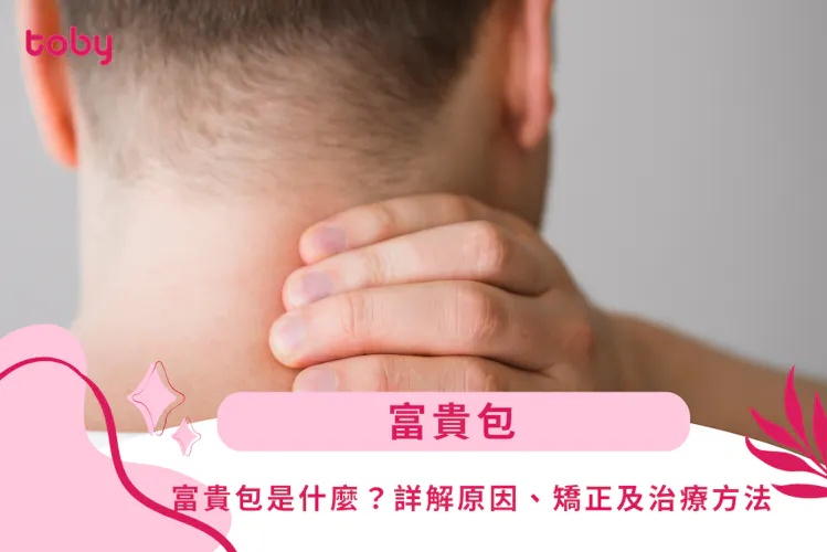 【富貴包】富貴包是什麼?詳解原因、矯正及治療方法-banner
