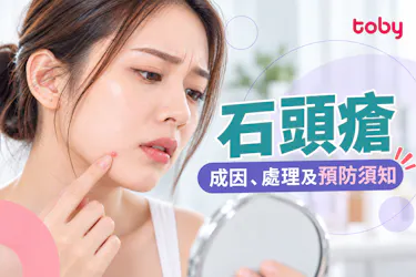 【石頭瘡】無膿但好痛?一文睇清原因+正確處理及預防方法