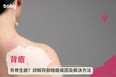 【背瘡】背脊生瘡?詳解背部暗瘡成因及解決方法