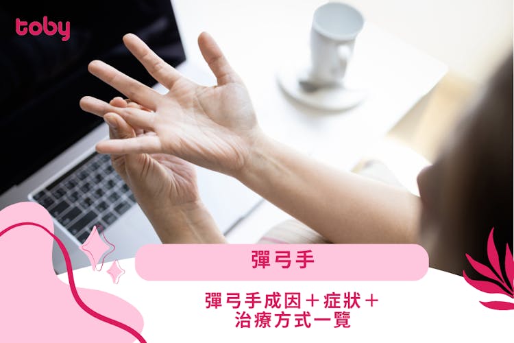 【彈弓手】彈弓手成因+症狀+治療方式一覽-banner
