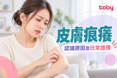 【皮膚痕癢】轉季全身痕癢難耐?一文詳解風癩原因及皮膚敏感食療法
