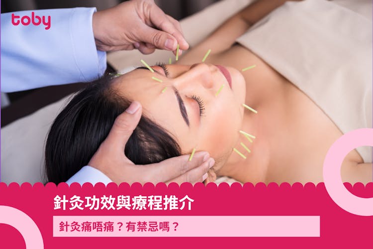 針灸功效與療程推介|針灸痛唔痛?有禁忌嗎?-banner
