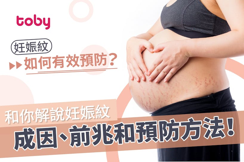 【妊娠紋】如何有效預防？和你解說妊娠紋成因、前兆和預防方法！-banner