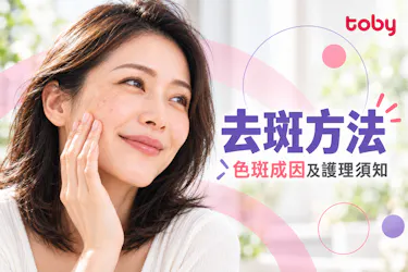【去斑】去斑方法邊個好?一文睇清色斑成因、去斑方法比較