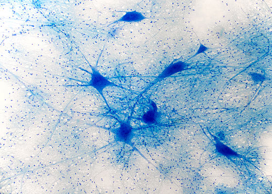 Image of brain neurons