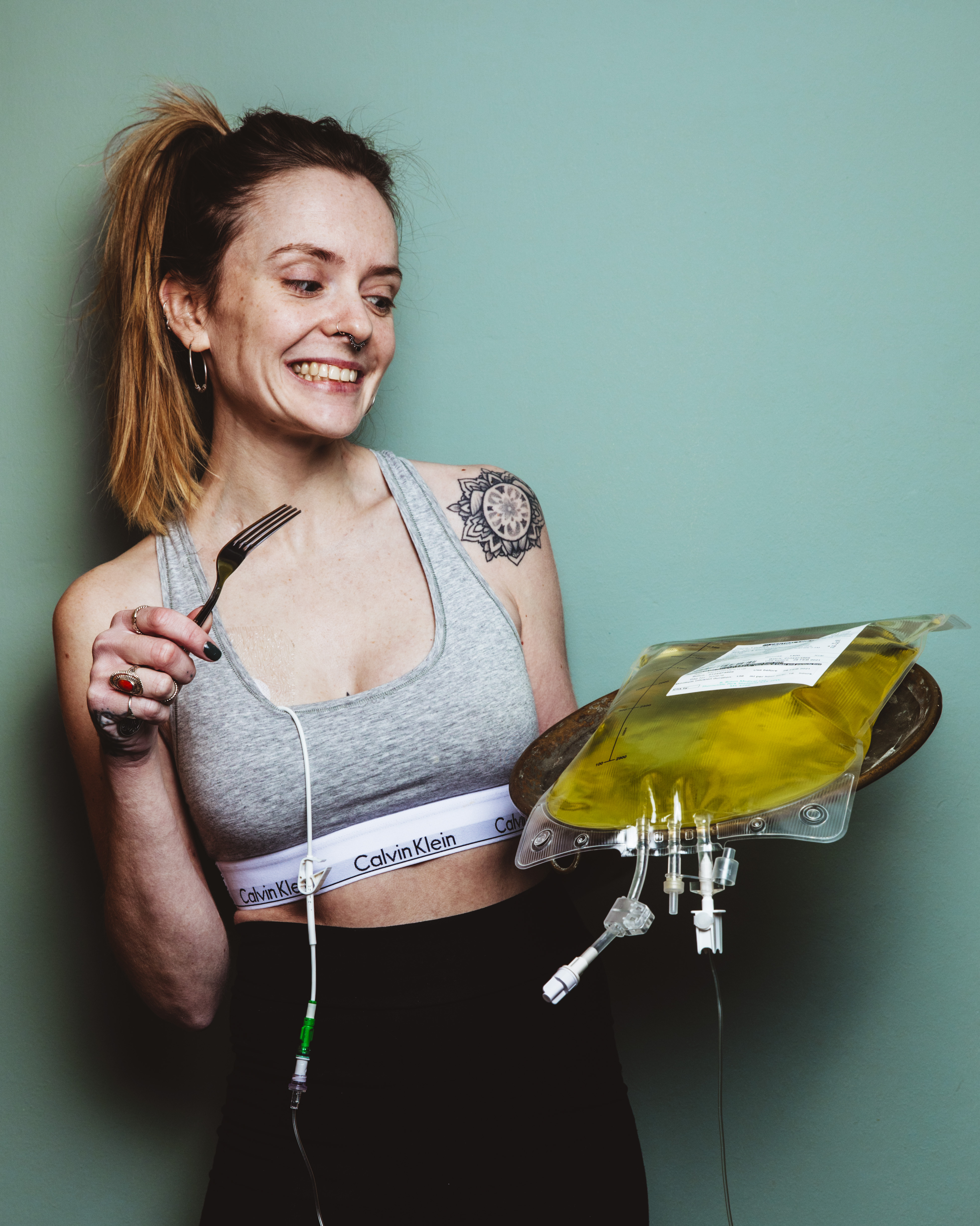 Loretta Harmes, The Nil By Mouth Foodie, holds her TPN feeding tube bag on a platter.