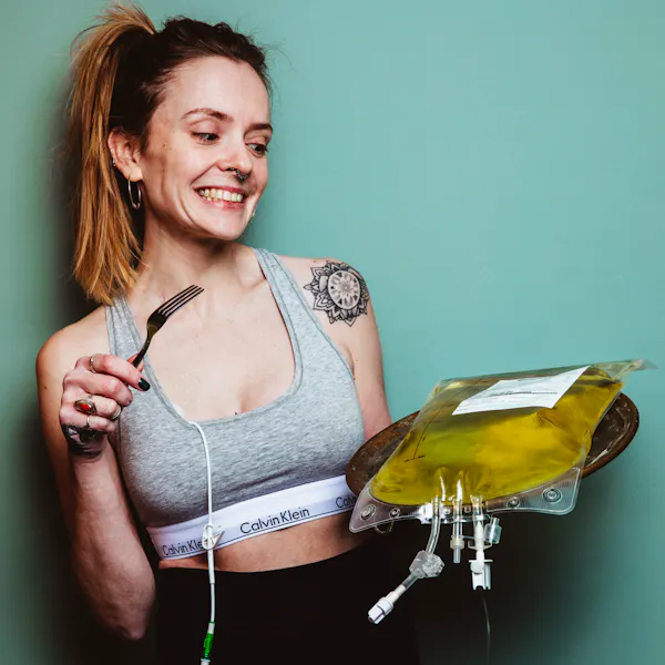 Loretta Harmes, The Nil By Mouth Foodie, holds her TPN feeding tube bag on a platter.