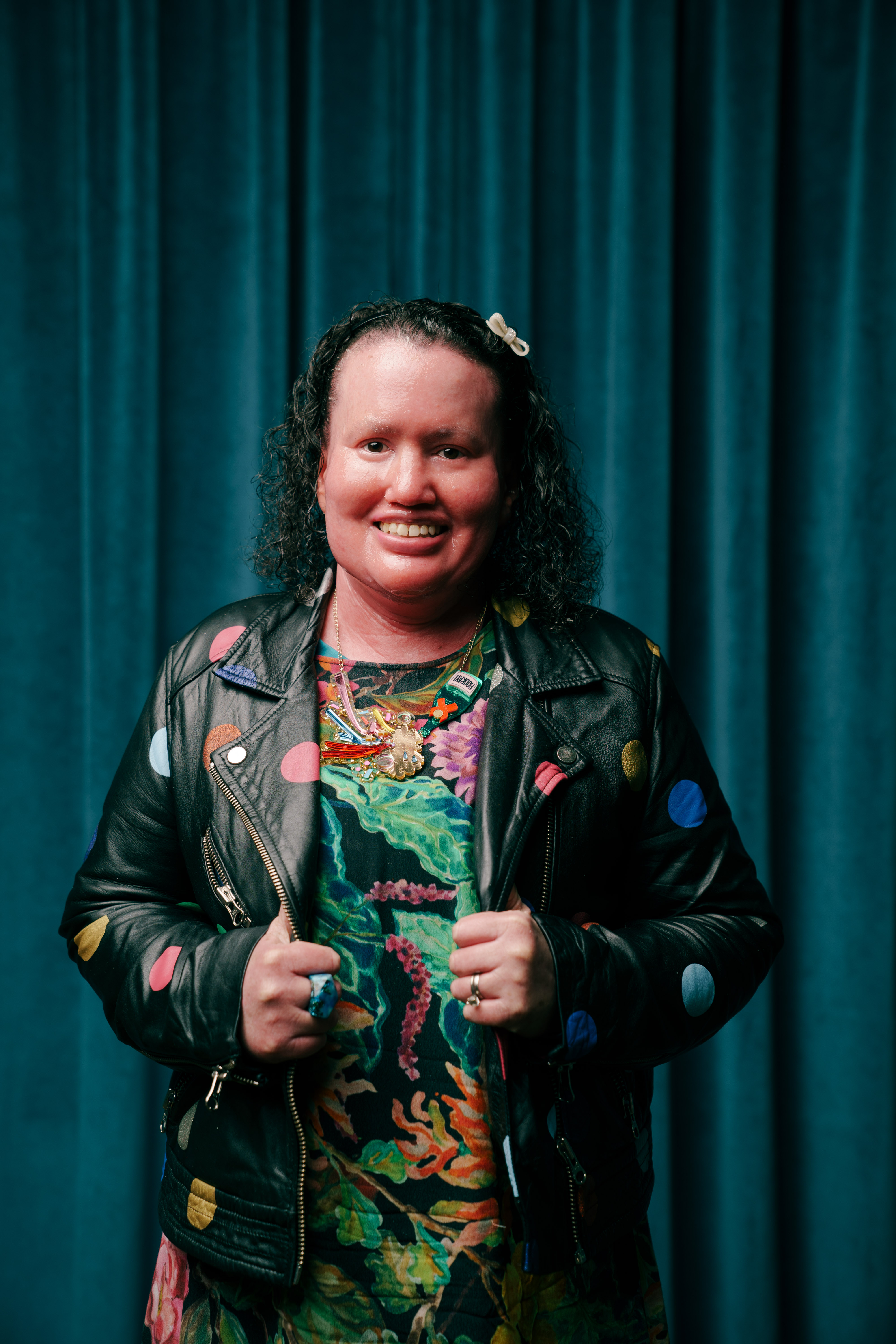 Carly Findlay is standing in front of a blue curtain and smiling at the camera. She's wearing a colourful dress and a polka dot leather jacket. 