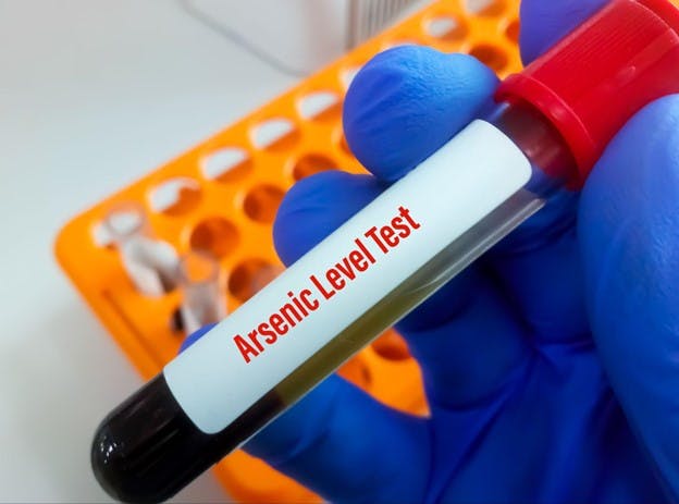 Arsenicosis Level Test