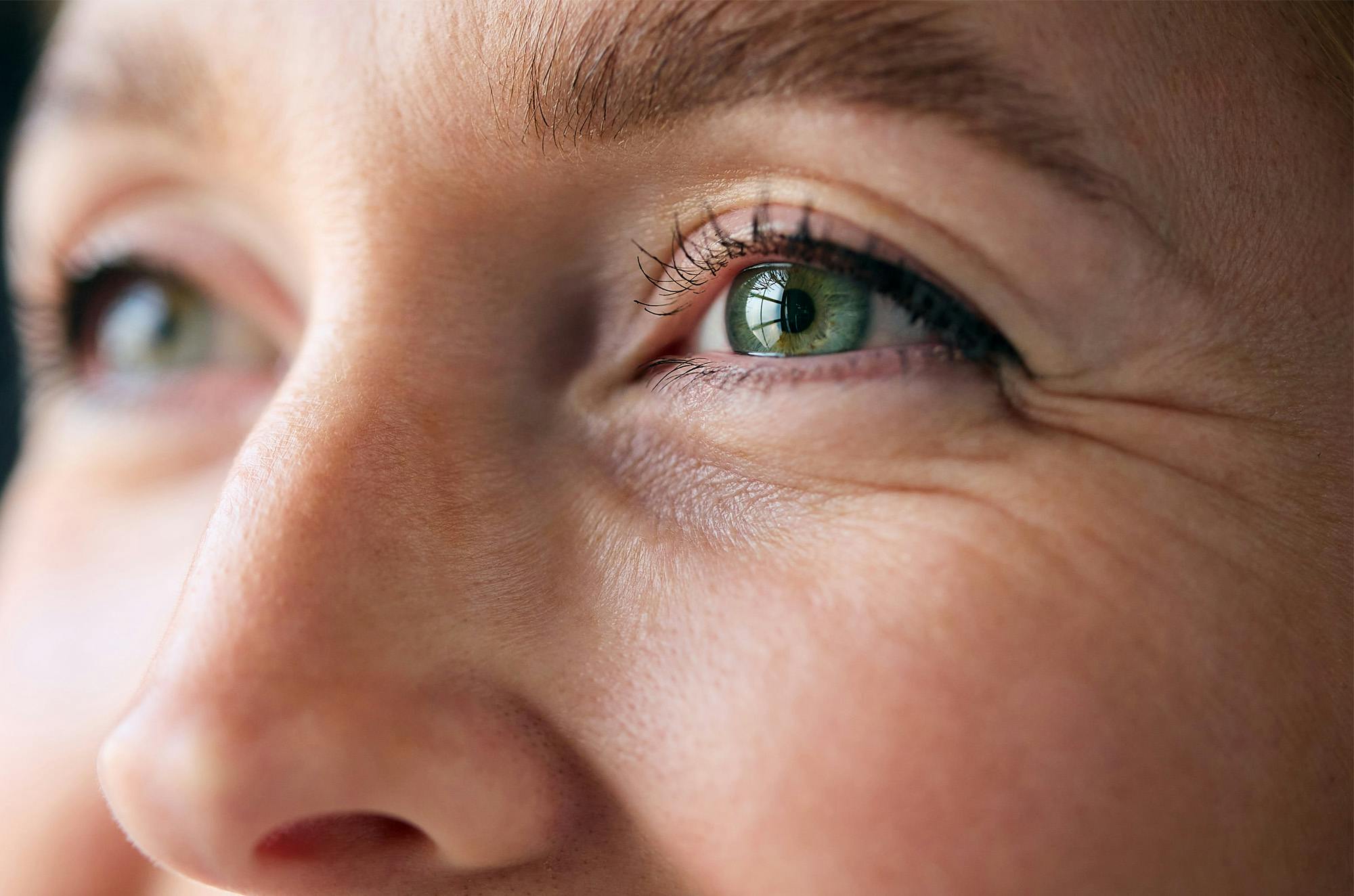 A woman with lines and wrinkles around her eyes