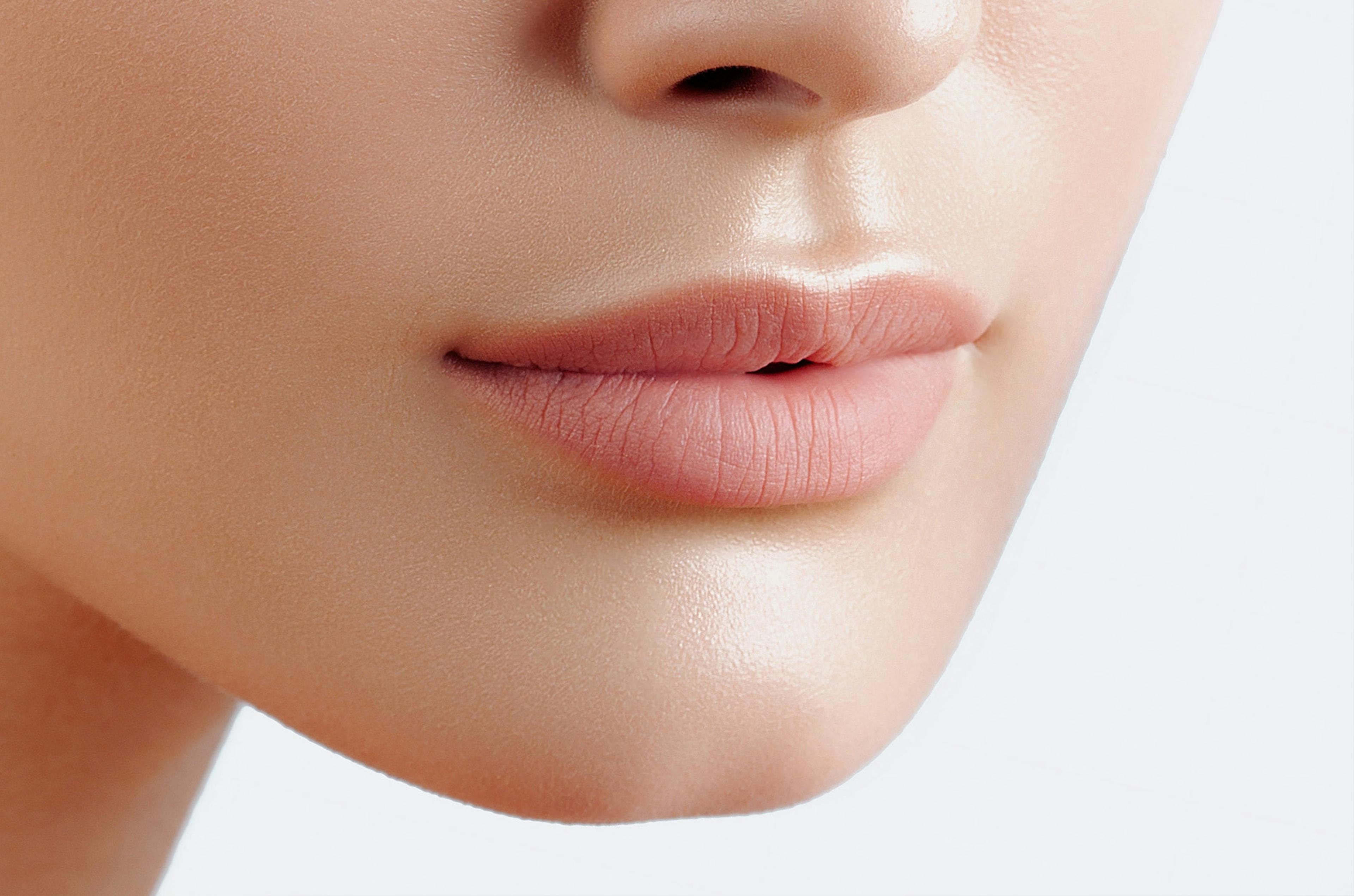 A closeup of a woman's lips following lip filler treatment