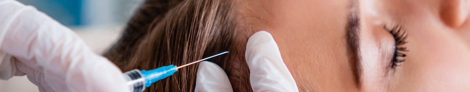 Woman receiving injections into her scalp area as part of her hair regrowth treatment