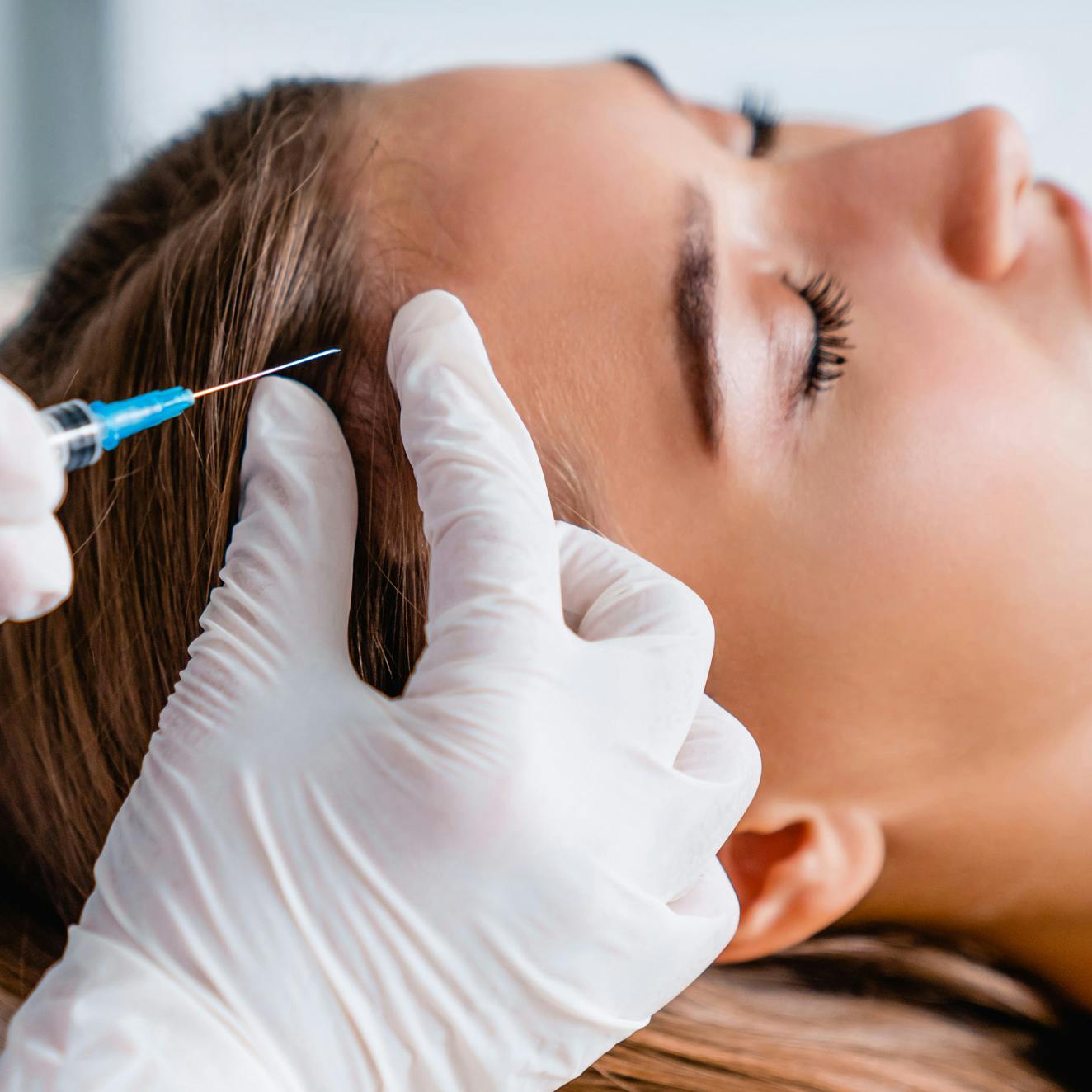Woman receiving injections into her scalp area as part of her hair regrowth treatment